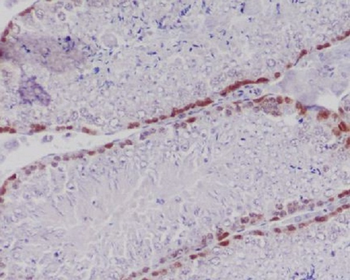 Caspase-2 Rabbit mAb [KD Validated]
