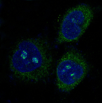 PUMA Rabbit mAb Antibody