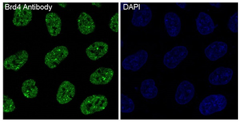 Brd4 Rabbit mAb Antibody