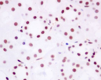 Brd4 Rabbit mAb Antibody