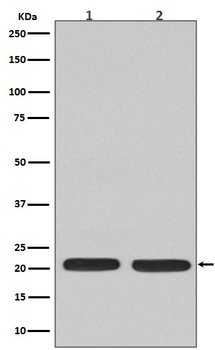 Ras Rabbit Monoclonal Antibody
