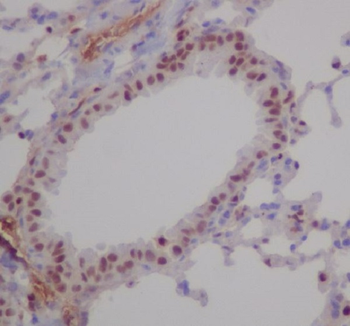 RUNX1/RUNX2/RUNX3 Rabbit mAb  [KD Validated]