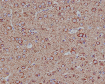 beta II Tubulin Rabbit mAb