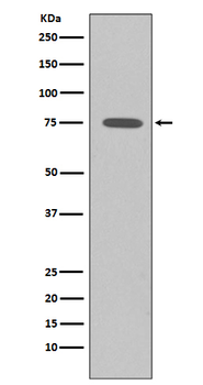 Somatostatin Receptor 2 Rabbit Monoclonal Antibody