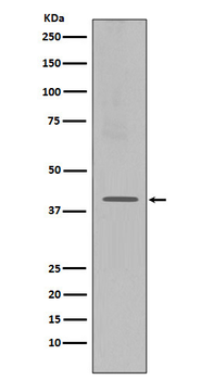 CXCR4 Rabbit mAb