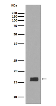 alpha + beta Synuclein Rabbit mAb