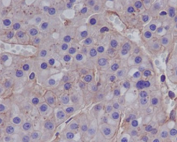MMP1 Rabbit mAb Antibody