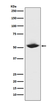 MMP1 Rabbit mAb Antibody
