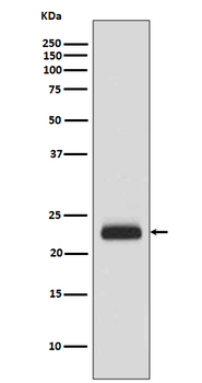 RAIDD Rabbit mAb Antibody