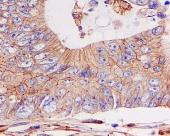 pan Cadherin Rabbit mAb