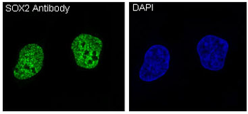 SOX2 Rabbit mAb Antibody