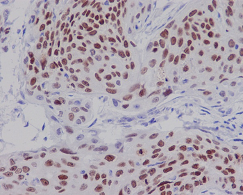 SOX2 Rabbit mAb Antibody