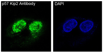 p57 Kip2 Rabbit mAb Antibody