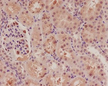 p57 Kip2 Rabbit mAb Antibody