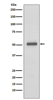 p57 Kip2 Rabbit mAb Antibody