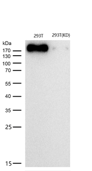 ErbB2 (HER2) Rabbit mAb [KD Validated] Antibody