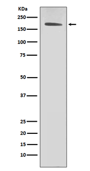 ErbB2 (HER2) Rabbit mAb [KD Validated] Antibody