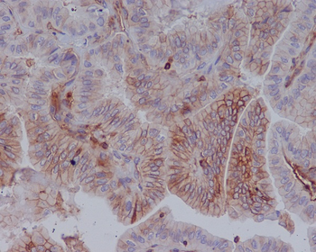 MHC class 1 Rabbit mAb Antibody