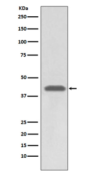 MHC class 1 Rabbit mAb Antibody