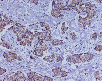 BMP4 Rabbit mAb Antibody