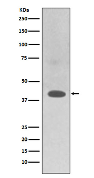 TRAM2 Rabbit mAb Antibody
