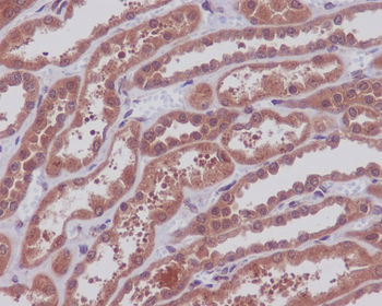 MEK1/2 Rabbit mAb