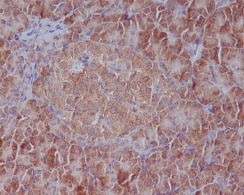 GRP78 BiP Rabbit mAb Antibody