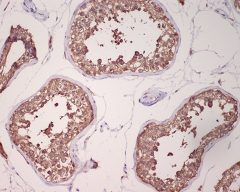 GRP78 BiP Rabbit mAb [KD Validated]