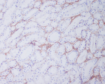 Collagen I Rabbit mAb