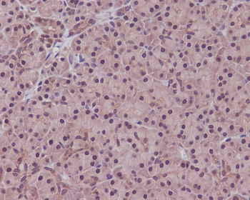 PPP1CA+PPP1CB Rabbit mAb Antibody