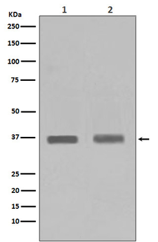 PPP1CA+PPP1CB Rabbit mAb Antibody
