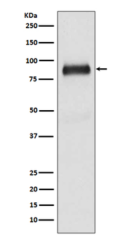 SATB2 Rabbit mAb Antibody