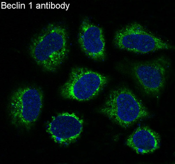 Beclin 1 Rabbit mAb Antibody