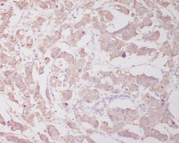 Beclin 1 Rabbit mAb Antibody