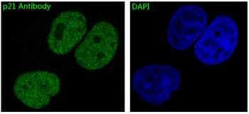 p21 Rabbit mAb Antibody