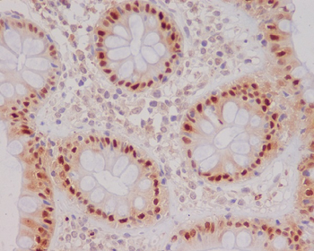 p21 Rabbit mAb Antibody