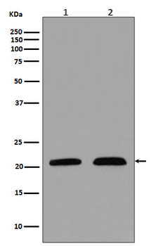 p21 Rabbit mAb Antibody
