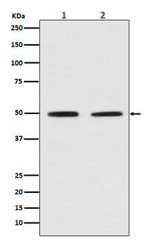 Pygopus 2 Rabbit mAb Antibody