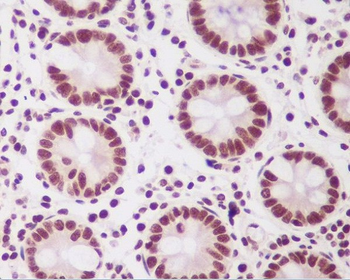 PTBP2 Rabbit mAb Antibody