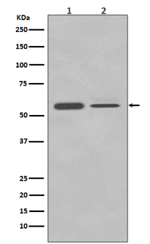 PTBP2 Rabbit mAb Antibody