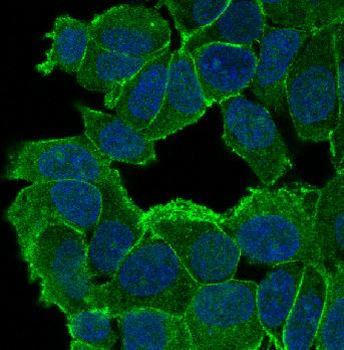 delta 1 Catenin/p120 Catenin Rabbit mAb Antibody