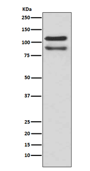 delta 1 Catenin/p120 Catenin Rabbit mAb Antibody
