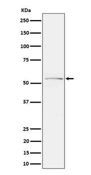 Tau (Phospho-Ser214) Rabbit mAb Antibody
