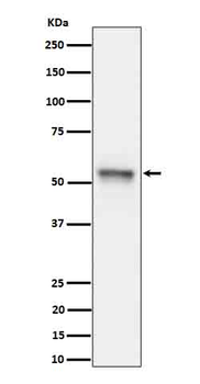 Tau (Phospho-Ser199) Rabbit mAb Antibody