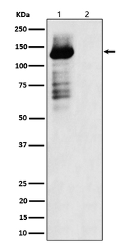TAOK1/2/3 (Phospho-Ser181/Ser181/Ser177) Rabbit mAb Antibody