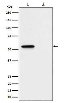 MLKL (Phospho-Ser345) Rabbit mAb Antibody