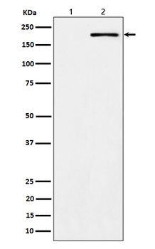 ErbB2 (Phospho-Tyr1139) Rabbit mAb Antibody
