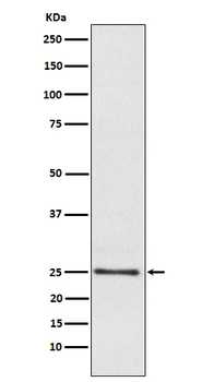 Lysophospholipase 1 Rabbit Monoclonal Antibody