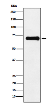 PAK4 + PAK5 + PAK6 (S474 + S560 + S602) Rabbit mAb Antibody