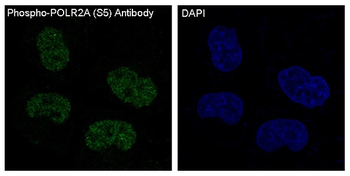 POLR2A (Phospho-Ser5) Rabbit mAb Antibody